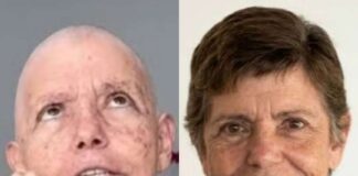 Após tratar câncer raro, ROSEANA SARNEY lança pré-candidatura ao Senado: "Não me esqueceram", diz ROSEANA, líder nas pesquisas